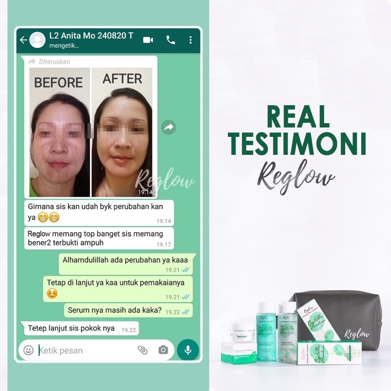 Skincare Series Paket Lengkap Original 100% BPOM - Reglow-5