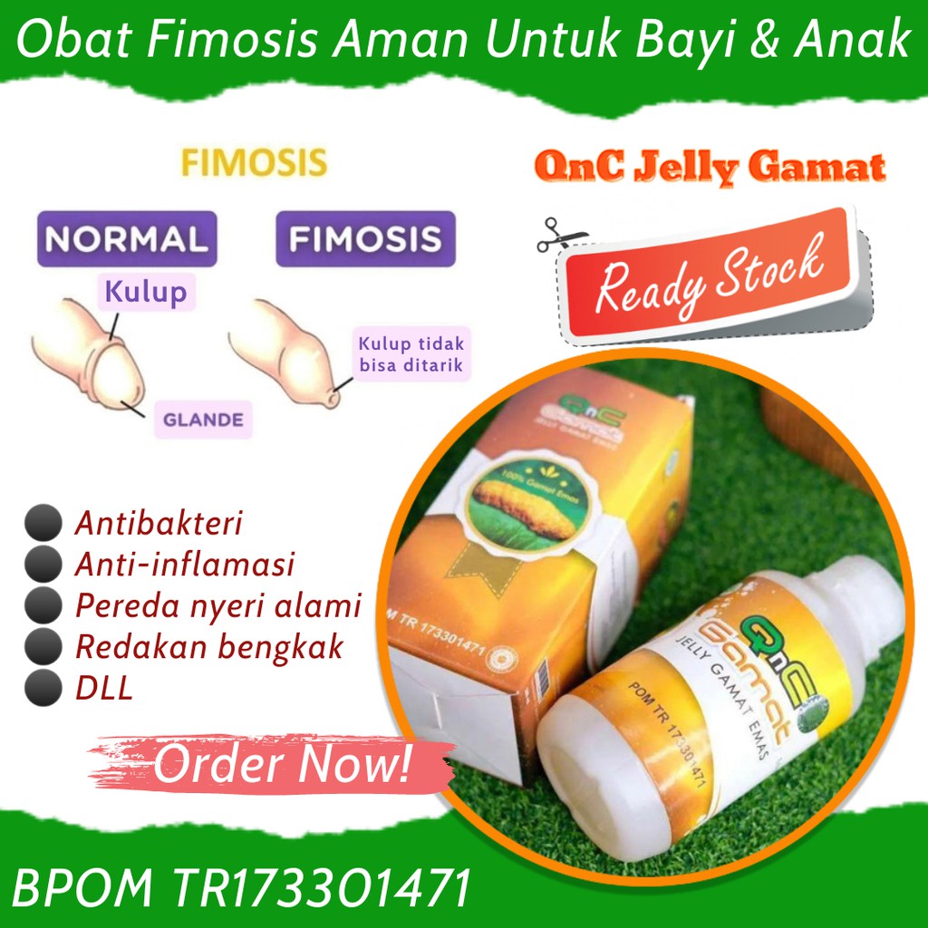 Obat Fimosis Pada Anak dan Dewasa - Kulup Penis Tidak Bisa Ditarik - Obat Phimosis Untuk Bayi