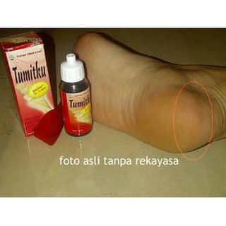 TUMITKU ORIGINAL Obat Kaki Pecah Ampuh Mengatasi Tumit Pecah COD