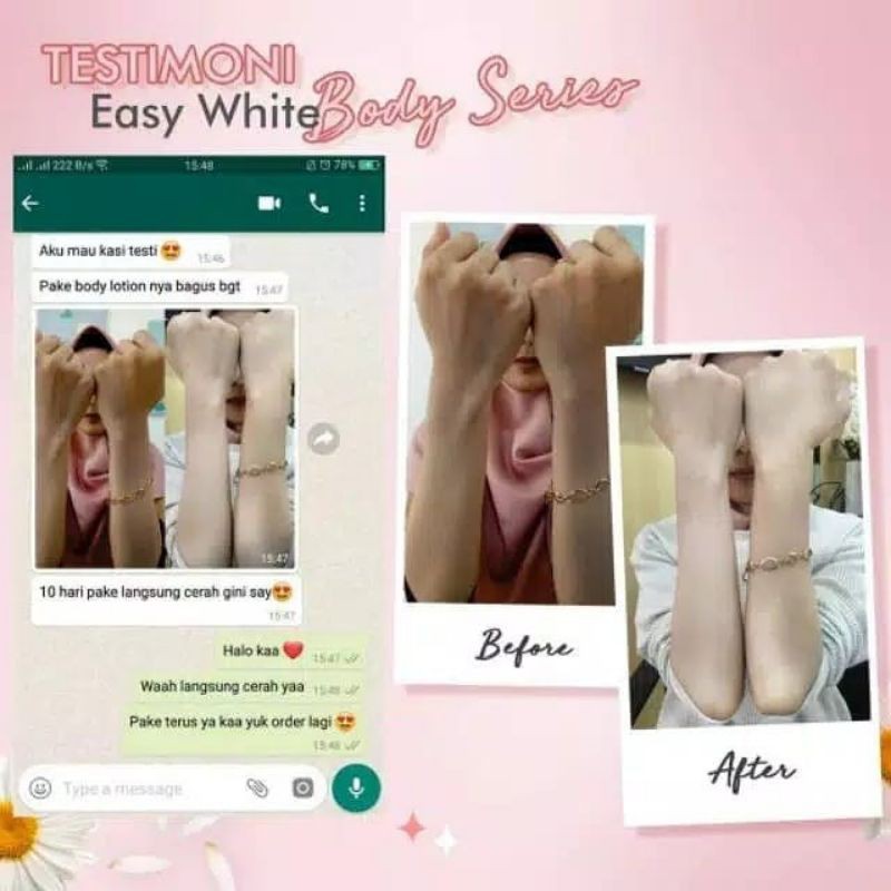 PAKET BODY LOTION BODY SERUM MS GLOW / Ms Glow Easy White Body Series