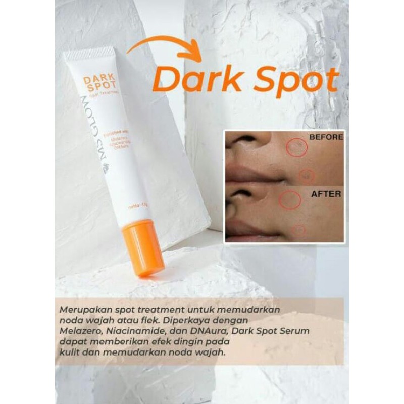 

Dark Spot