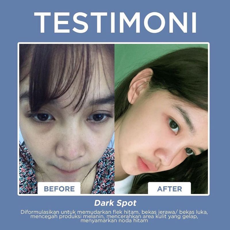 PROMO SPOT TREATMENT MSGLOW DARK SPOT PORE AWAY ACNE SPOT