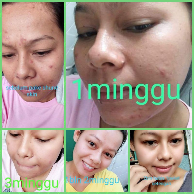 

SHINESKINPEKANBARU