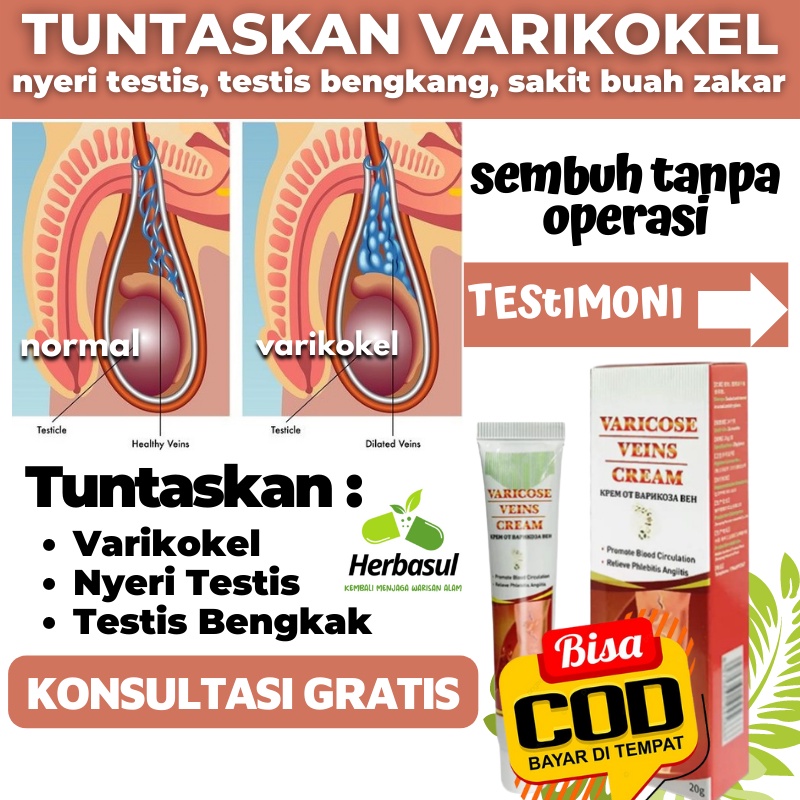 Herbasul | Obat Varikokel Salep Varises Cream Varicose Veins Obat Buah Zakar Bengkak Obat Varises Ke
