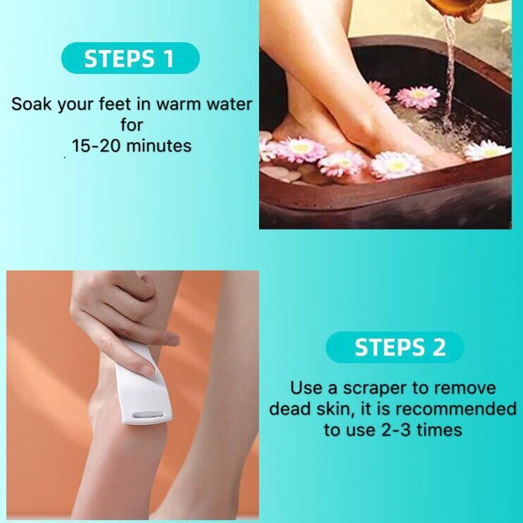 1pc Alat Kikir Kaki Penghilang Kulit Mati / Callus Warna Putih Untuk Pedicure