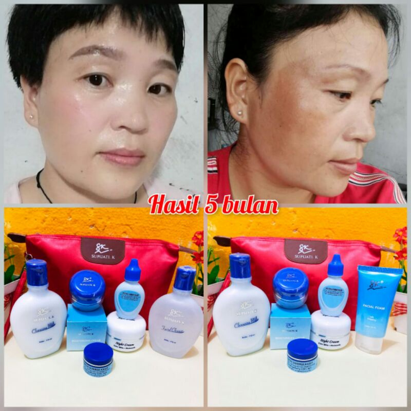 Paket Flek Hitam bandel Sk Supijati skincare