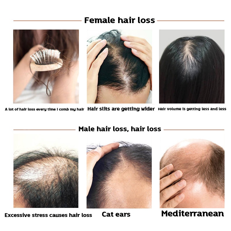 Shampo Jahe 500ml Shampo Penumbuh Rambut Tebal Anti Ketombe Gatal Anti Rambut Rontok Fast Grow Shampoo Perawatan Rambut Rontok