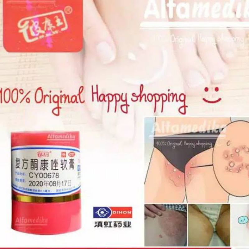 salep gatel paling manjur / salep gatel selangkangan / salep eksim kering / salep gatel cina-1