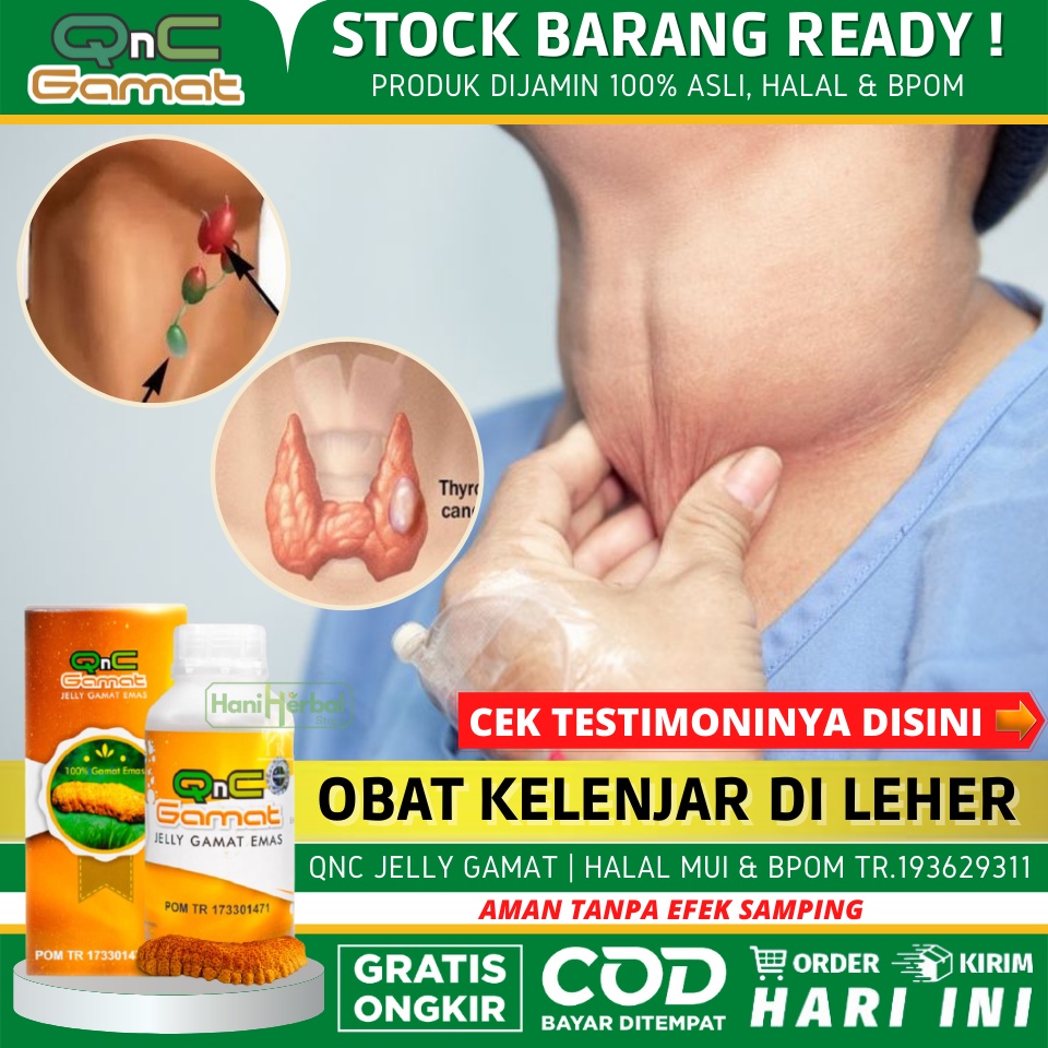 OBAT HERBAL TB KELENJAR, TB KELENJAR GETAH BENING, TBC, TB PARU, TUBERKOLOSIS - QNC JELLY GAMAT ASLI