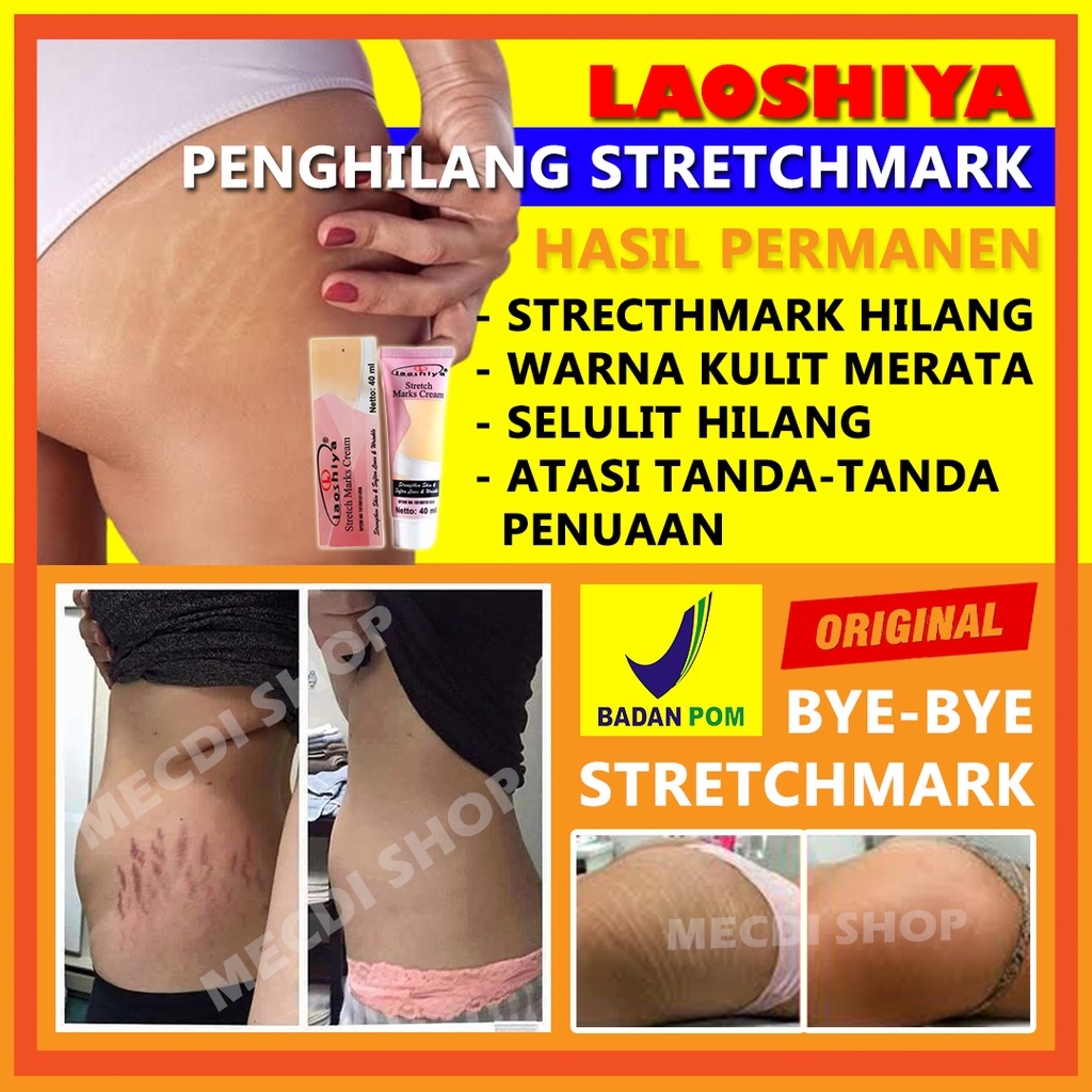 Cream Penghilang Strechmark Pencerah Lipatan Tubuh Perawatan Tubuh Penghilang Strechmark Tubuh Cream