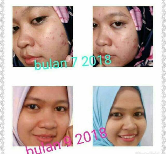 review pure skin 2 in 1 face wash and scrub