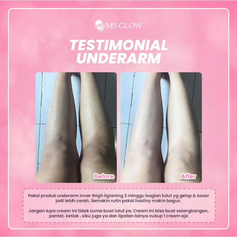 Ms Glow Underarm Ms Glow Original 100% Pemutih Ketiak Selangkangan Bokong Lip[Atan Tubuh Bpom