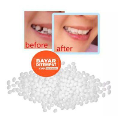 TEMPTOOT PENAMBAL GIGI/GIGI PALSU BUAT SENDIRI/GIGI KELINCI/GIGI TARING/ISI 15 BUTIR