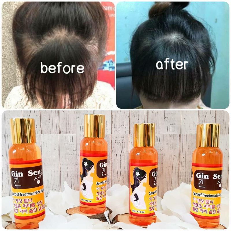 Hair Tonic Red Ginseng Korea Penumbuh Rambut