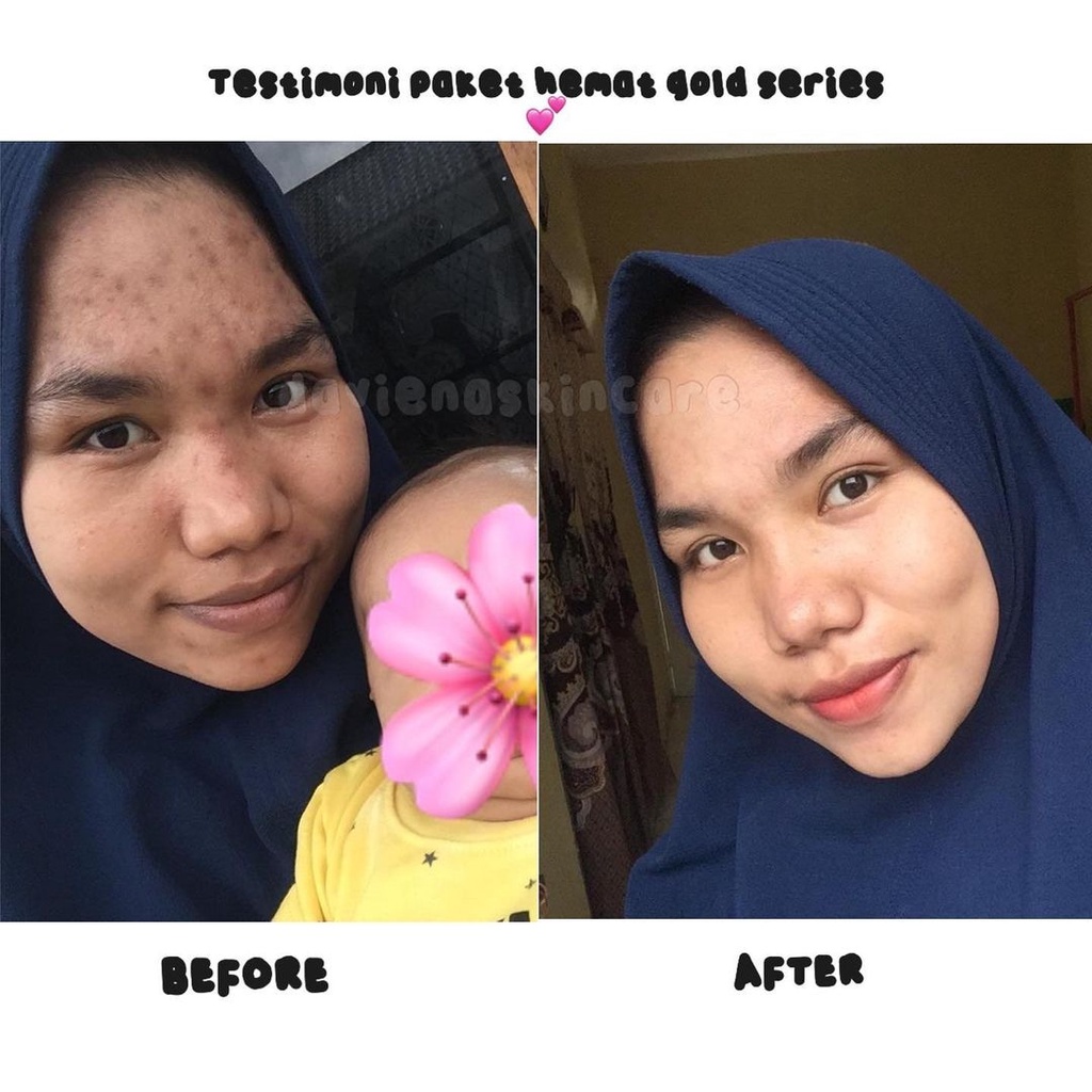 Daviena Skincare Gold Series