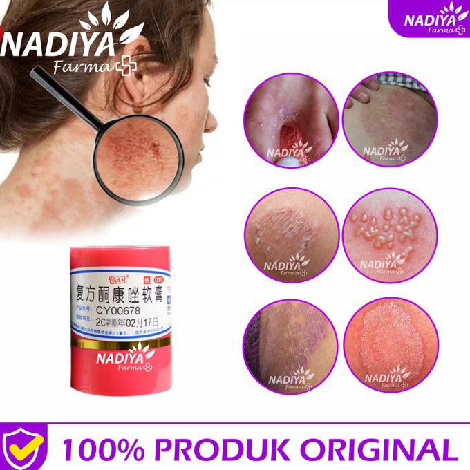 [[BISA COD]] Salep Obat Kulit Untuk Mengobati Penyakit Gatal Di Selangkangan