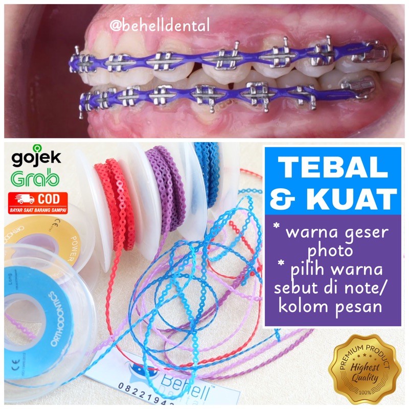Behelldental ORIGINAL &amp; PREMIUM Karet Behel Motif Power Chain Sambung Tarik 10 cm - Beli 1 Meter add 10x - Tebal Kuat Awet - Ortho Orthodontic Power Chain - Rubber Braces Bracket
