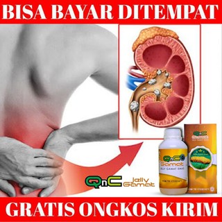 Obat Batu Empedu Batu Ginjal Sakit Ginjal Gagal Ginjal Ginjal Bocor Bengkak Qnc Jelly Gamat Shopee Indonesia