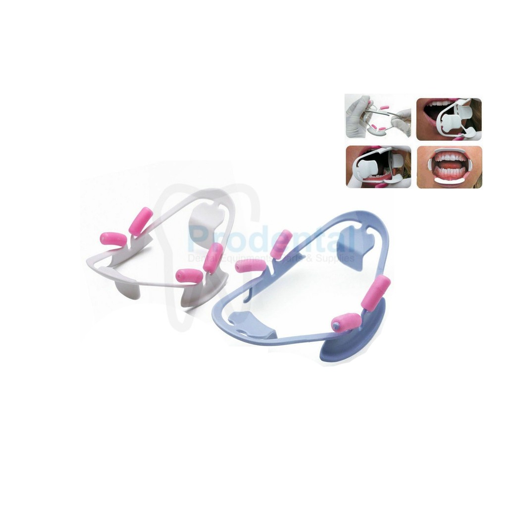 Oral Opener Cheek Retractor / Mouthgate Mouth Gag 3D