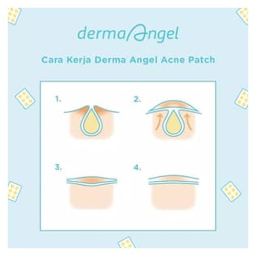 Derma Angel Acne Patch Sticker Jerawat | Derma Angel Acne Gel