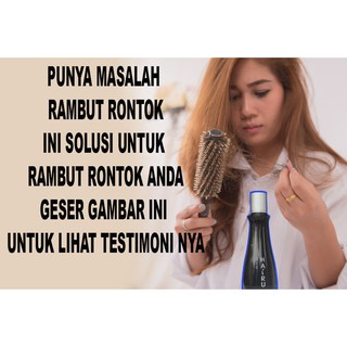  Vitamin  Rambut  Ampuh  Mengatasi Rambut  Rontok  Shopee 