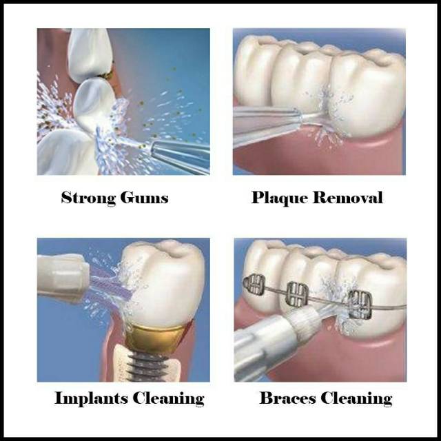 WATERPULSE WATER JET PICK FLOSSER TEETH TOOTH V400 / WATERPULSE DENTAL FLOSSER  PEMBERSIH GIGI V 400 plus