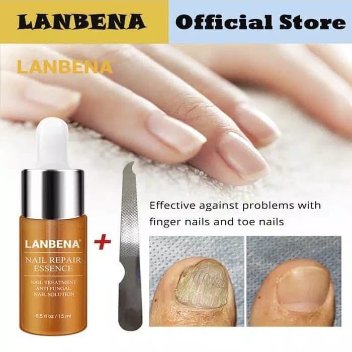 ready Lanbena Kuku Perbaikan Essence Serum Jamur Perawatan Kuku