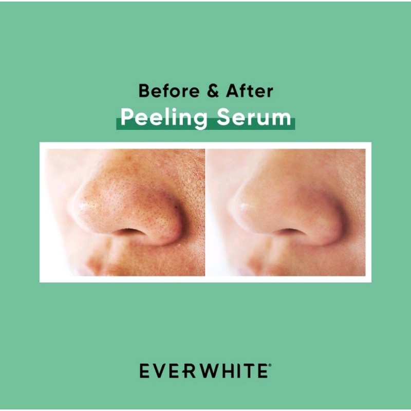 EVERWHITE Serum Series | Cica Soothing | Chromabright | Niacinamide | Aha Bha |Multi Action |Peptide