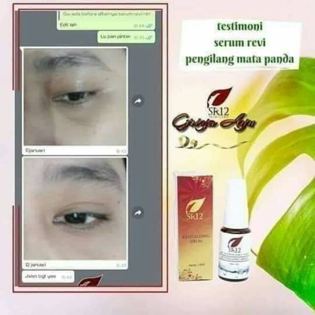 RERIVATILIG SERUM AMPUH ATASI MATA PANDA
