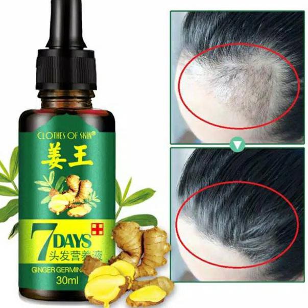 Penyubur Rambut Serum Rambut Rontok Herbal 30 ML