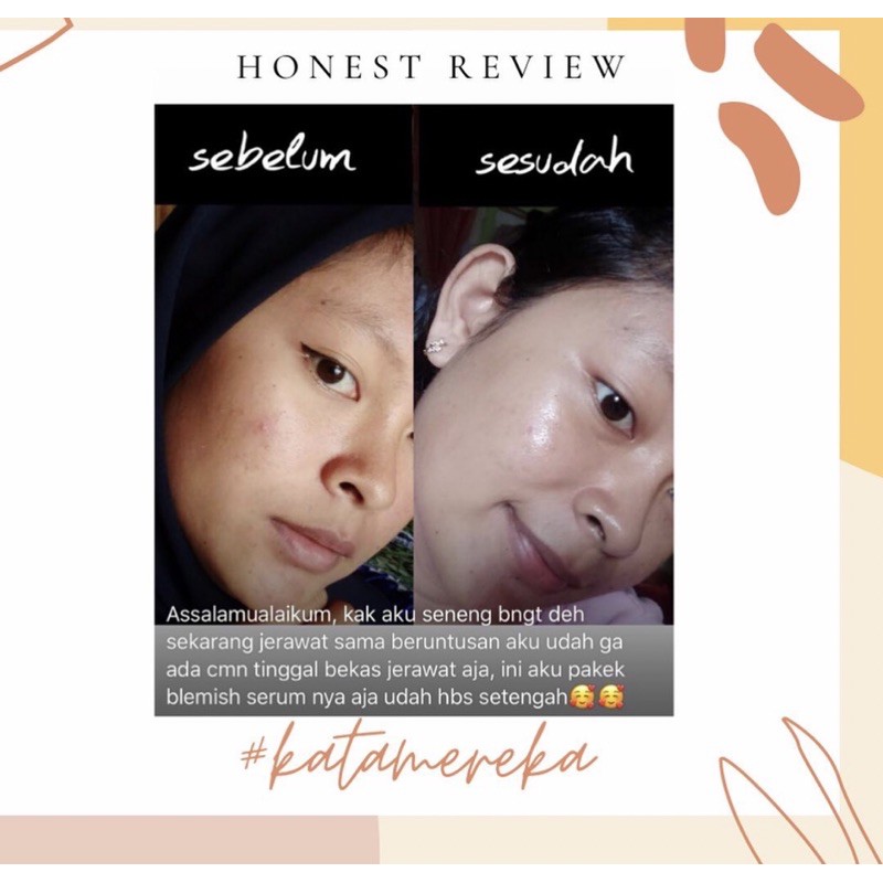 VAVL BEAUTY WATER / VIGHTNE BLEMISH SERUM /FACIAL CLEANSER / SUNSCREEN / BODY SERUM / PEELING SPARY