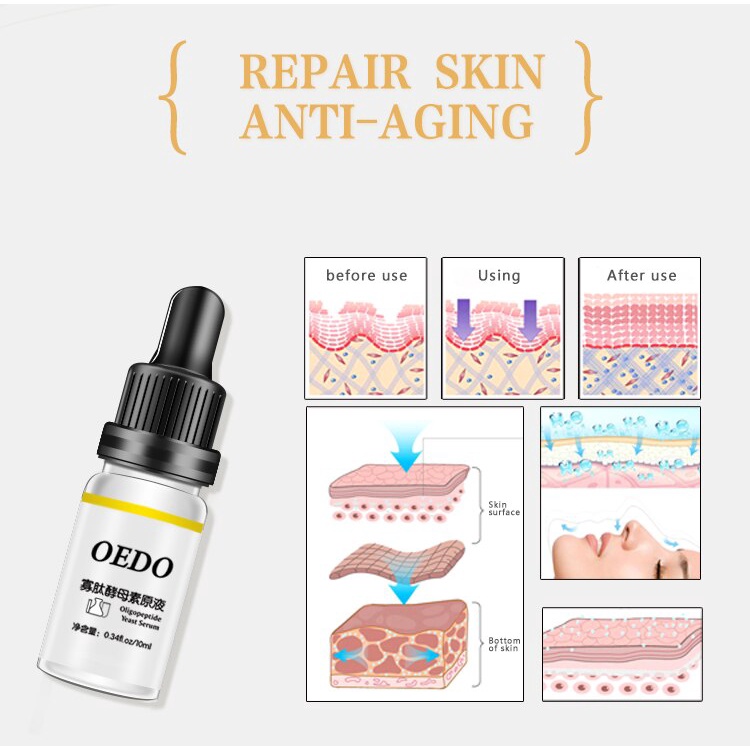 [Terbukti Alami] OEDO Oligopeptide Yeast Serum Anti-Aging Wajah Serum Kulit Anti Kerut Wajah