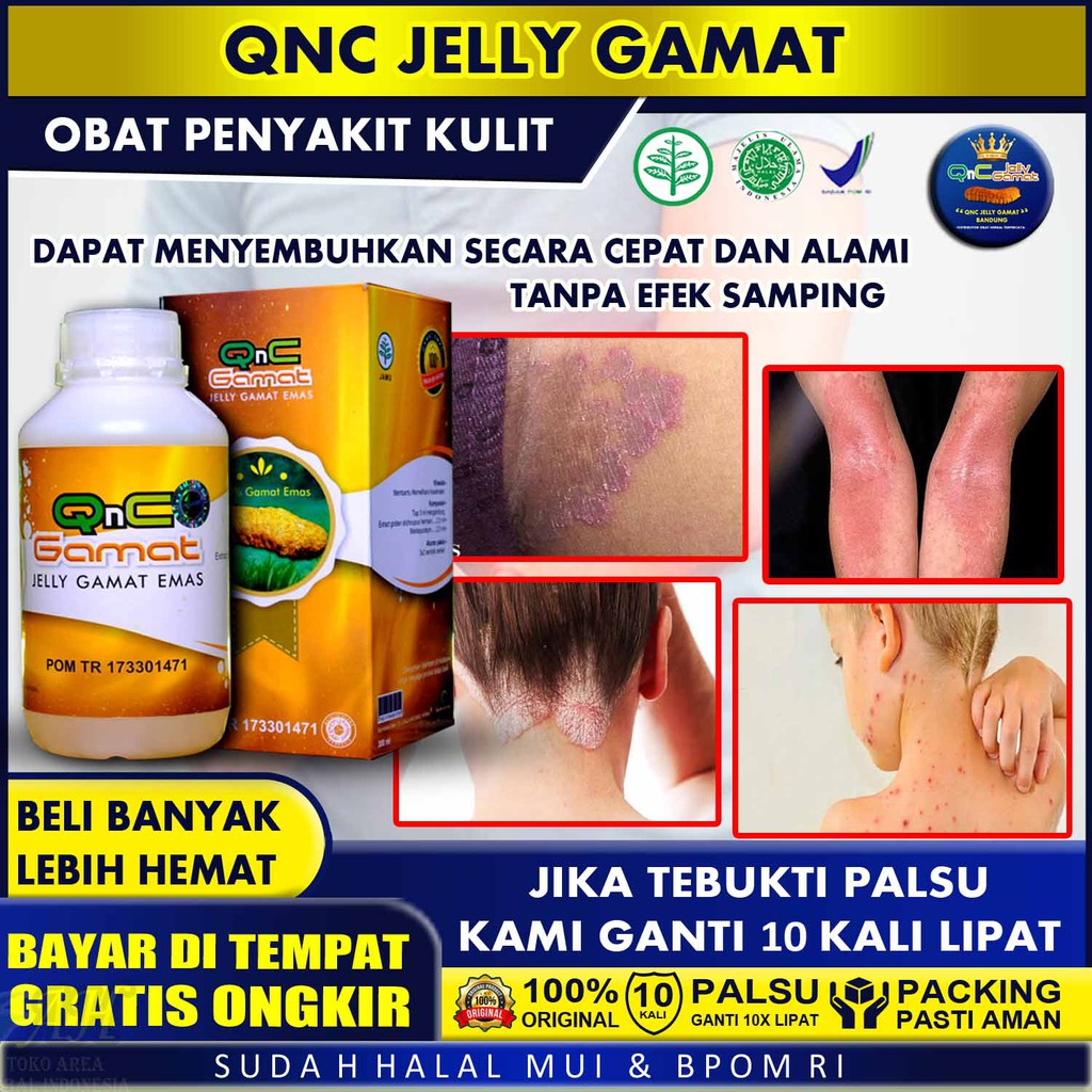 Obat Gatal Seluruh Tubuh - Obat Gatal Selangkakan Menghitam - Obat Alergi - QNC JELLY GAMAT ASLI