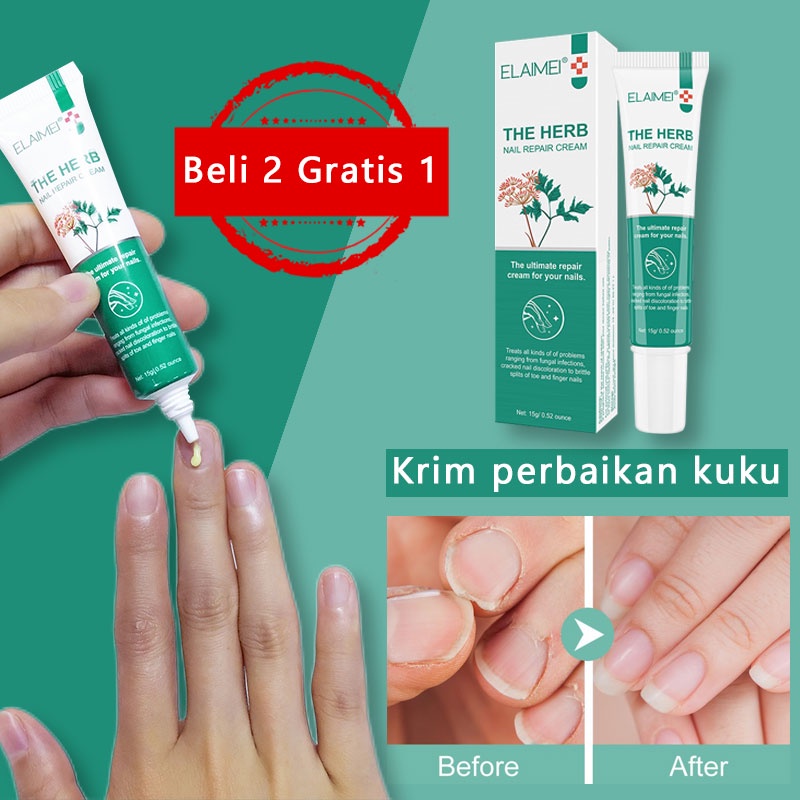 Jual Obat Jamur Kuku Onikomikosis Obat Jamur Kuku Tangan Krim Perbaikan