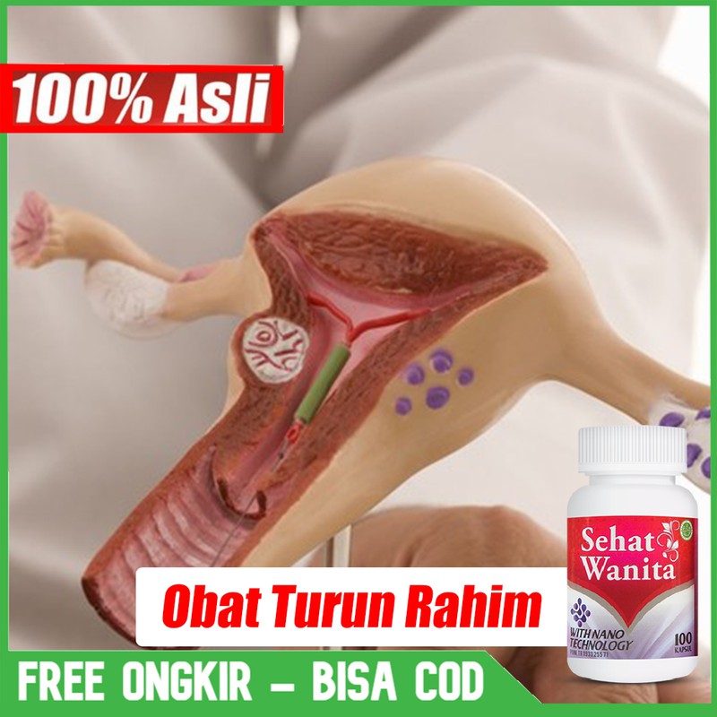 Obat Turun Rahim - Turun Peranakan Yang Aman Untuk Wanita - Sehat Wanita Kapsul Asli Bisa COD