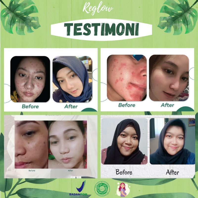 (FREE GIFT EMAS) - REGLOW SKINCARE GLOWING BY DR SHINDY PUTRI - ORIGINAL 100%