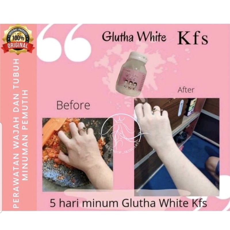 GLUTA WHITE KFS SUSU PEMUTIH KULIT MINUMAN COLAGEN Original
