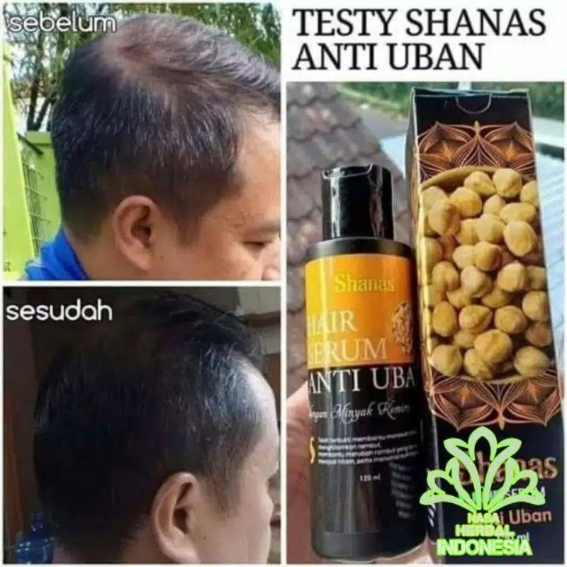 COD FREE ONGKIR Terlaris Serum Penghilang Uban Shampo Anti uban shanas ampuh