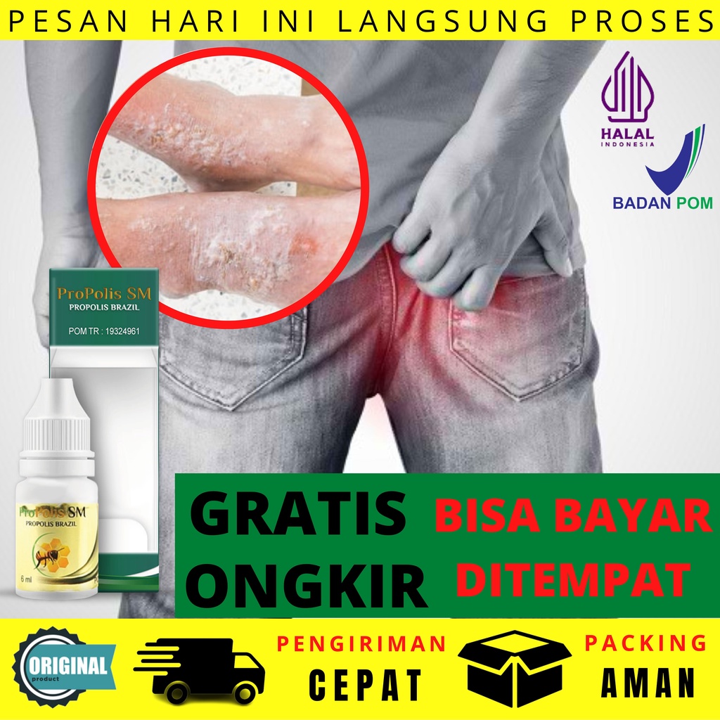 Obat Budug Pantat Kulit Gatal Bernanah Skabies Sekujur Tubuh Buduk Jerawat Lepuhan Bersisik Ruam Bin