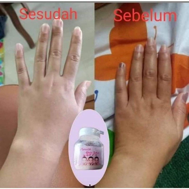 Gluta White KFS