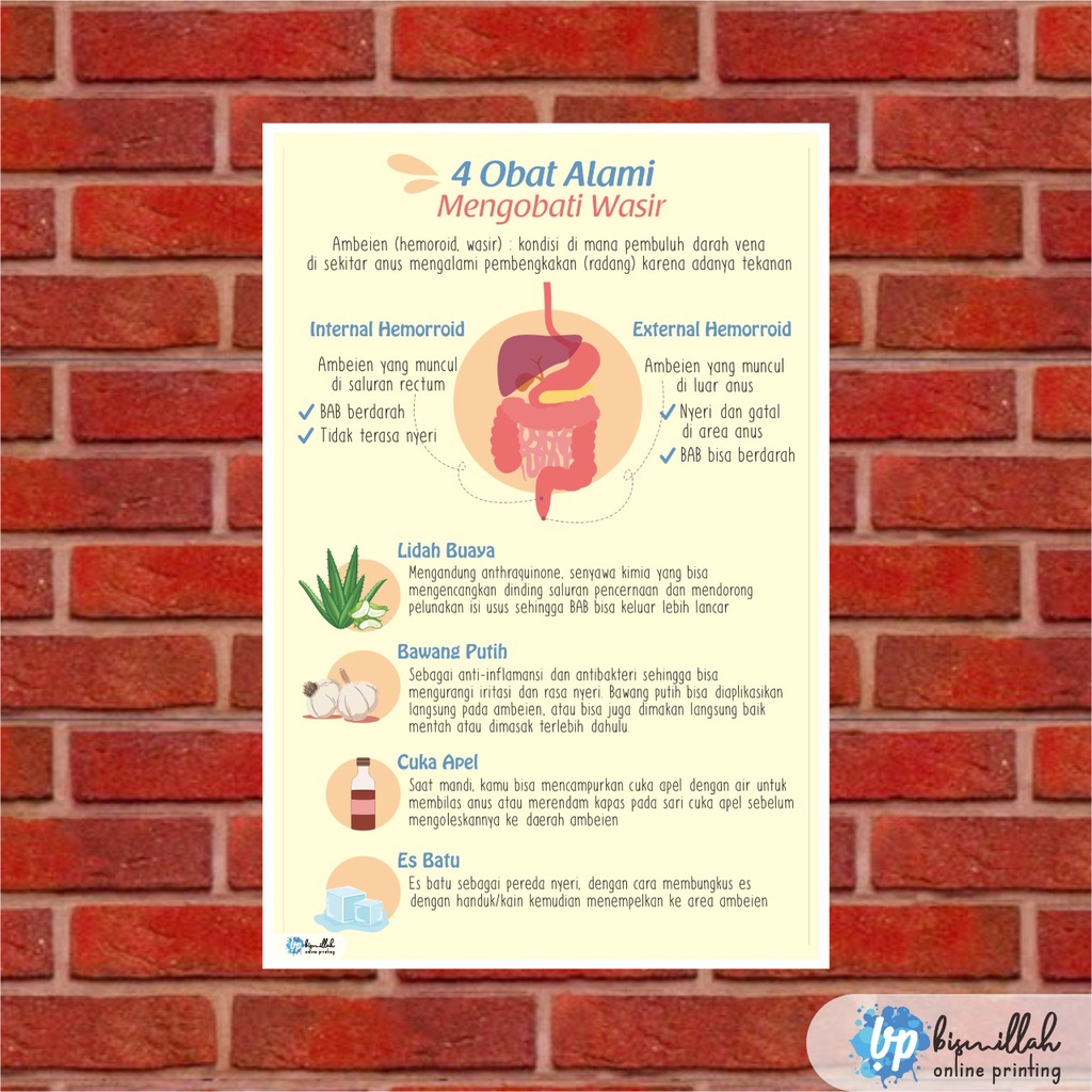 

Poster Kesehatan 4 Obat Alami mengobati Wasir