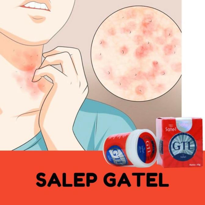 Salep Kulit Gatal Alergi Satel GTL BPOM