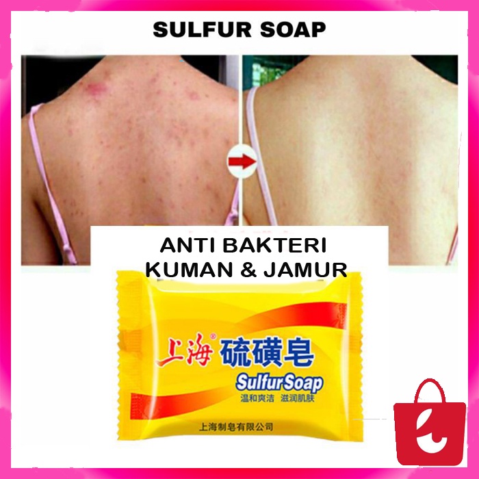 [100% Asli] Shanghai Sulfur Soap Sabun Shanghai Belerang Jerawat Anti Bakteri Gatal Jamur Kurap Kudis Panu