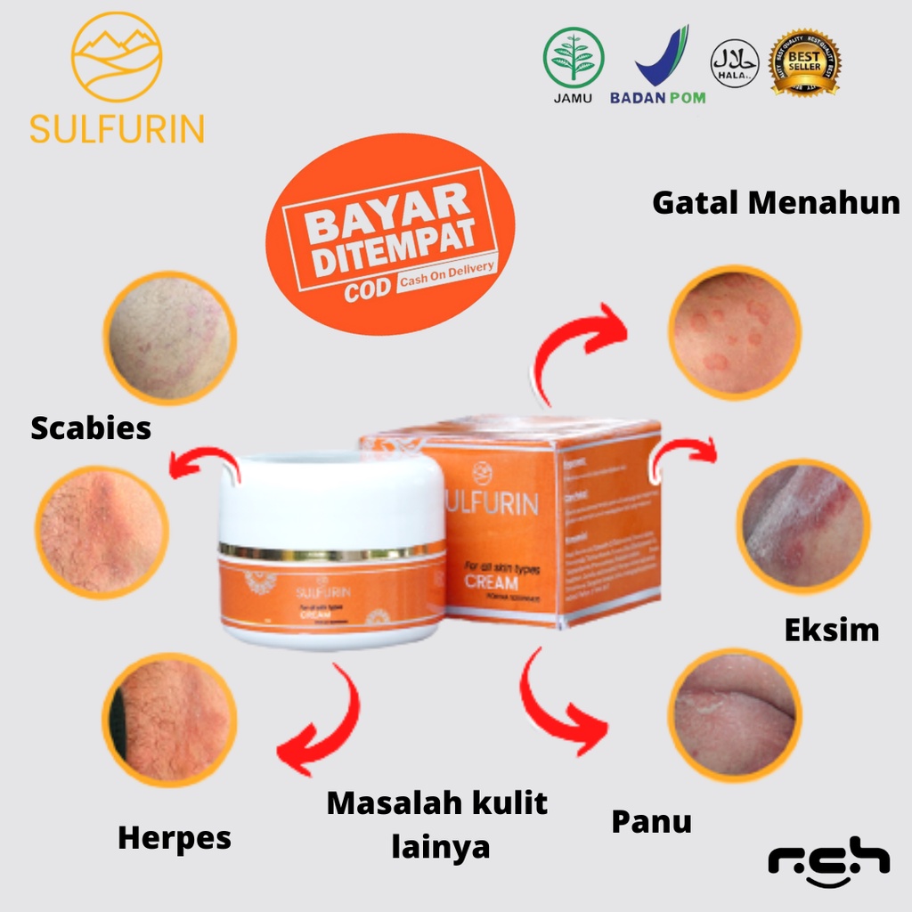 Sulfurin obat salep gatal selangkangan menahun kulit bintik merah Scabies Herpes ampuh BPOM