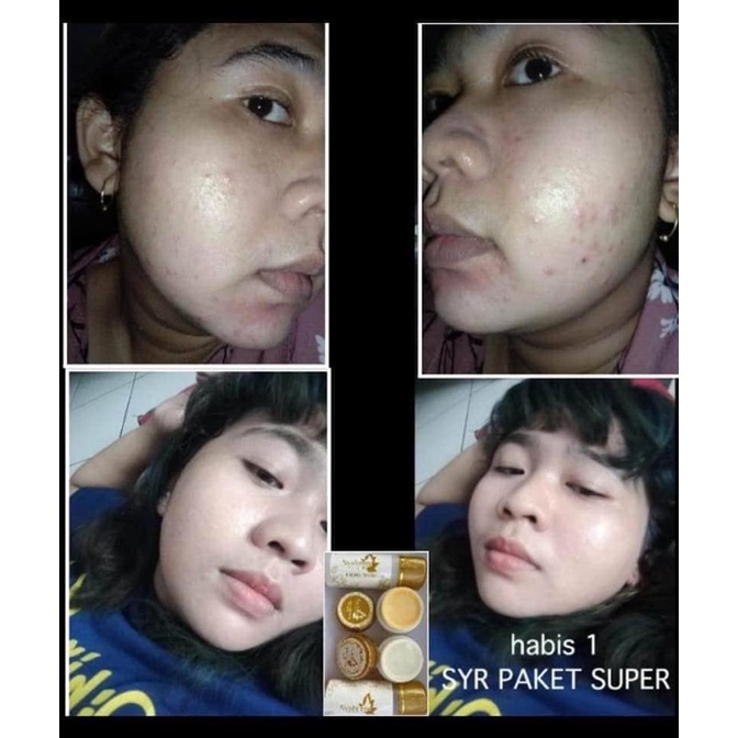 BISA (COD) SYAHRENI GLOWING PAKET SUPER / SYR GLOWING PAKET SUPER ORIGINAL