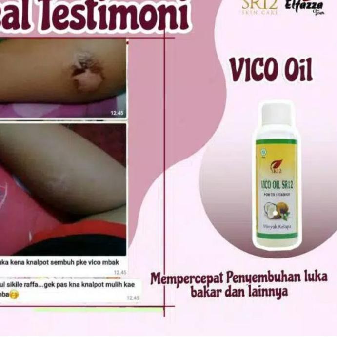 

ਸੀ4Ĵ11€ SR12 VICO VIRGIN COCONUT OIL MINYAK KELAPA MURNI >Termurah<