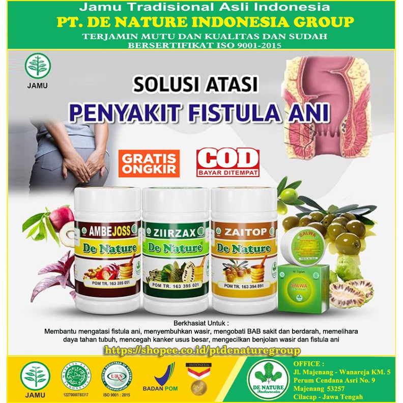 Obat Fistula Ani Ampuh De Nature