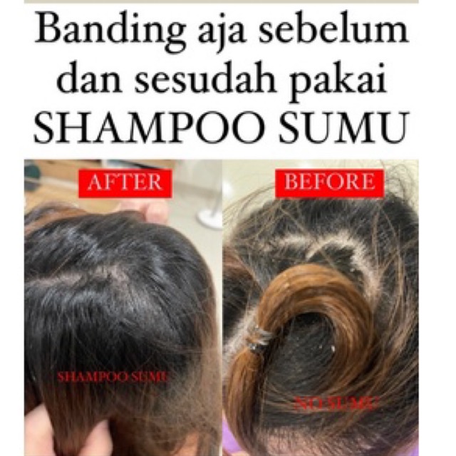 SUMU' ZU APPLE Super Shampoo &amp; Conditioner 500ml - Anti lepek, Anti rontok, Anti hair fall, Anti Dandruff ketombe, Perawatan grow baby hair