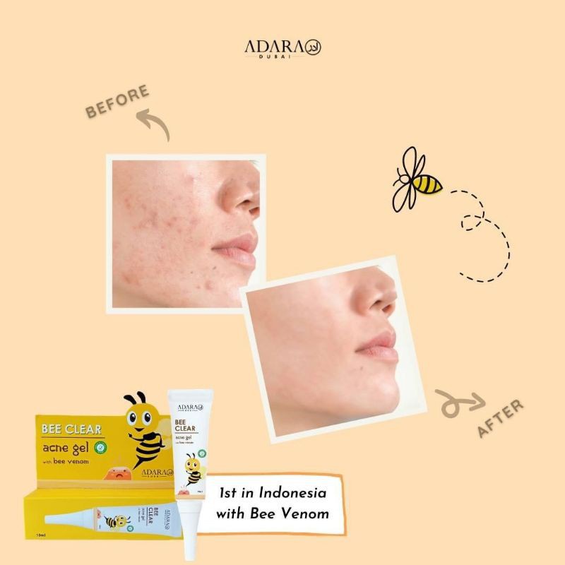 ADARA COSMETIC BEE CLEAR ACNE Gel With bee Venom 10ml