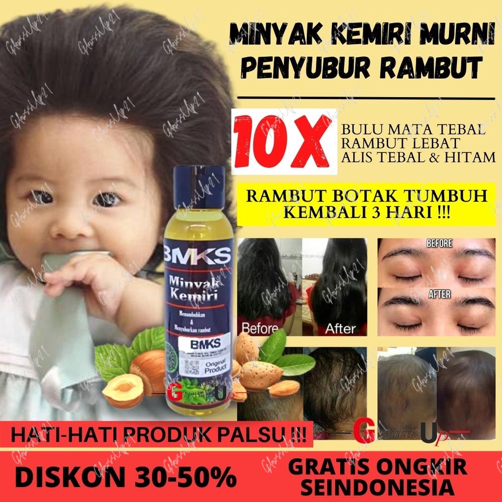 MINYAK KEMIRI BMKS - BMKS KEMIRI OIL PENUMBUH RAMBUT BOTAK TREATMENT RAMBUT